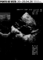 Punto de Vista: Permanencia de lo ef&iacute;mero 6